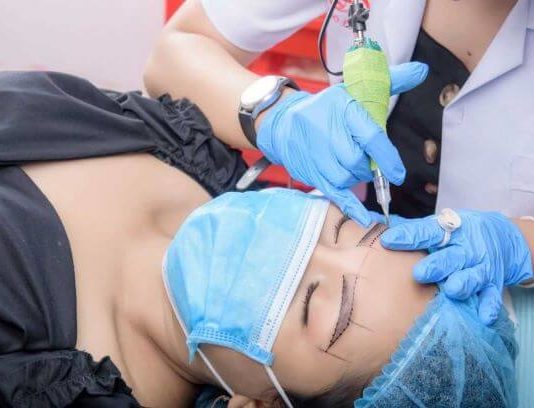 Détatouage sourcil sans laser_ la solution du microblading raté